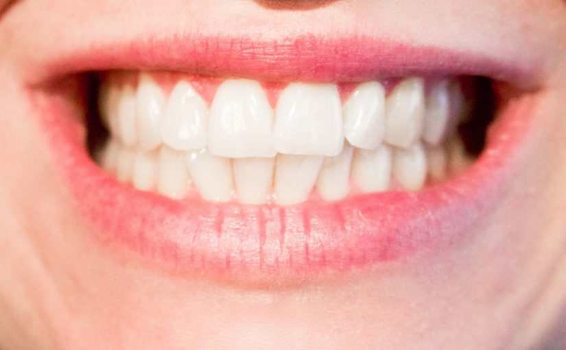Aktualna technologia stosowana w salonach stomatologii estetycznej być może spowodować, że odbierzemy śliczny uśmiech.